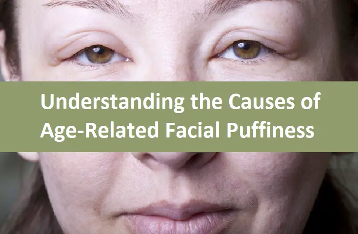 Understanding the Causes of Age-Related Facial Puffiness